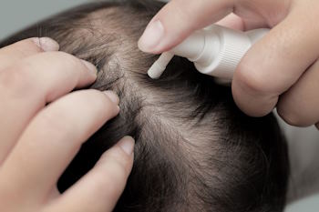 deciphering minoxidil